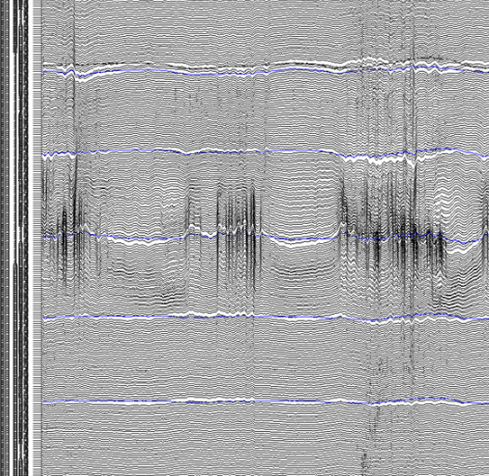 Hippocampal activity in health and disease