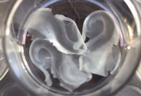 The Beauty and the Dish: Brain Organoids Go Active