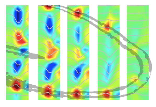 A consensus statement on detection of hippocampal sharp wave ripples and differentiation from other fast oscillations